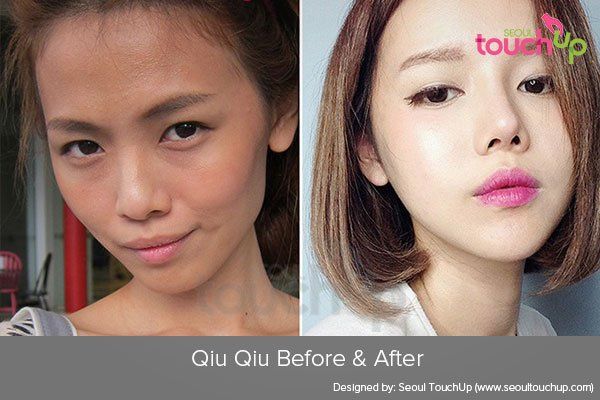 Virgo reccomend Asian nose job before and after