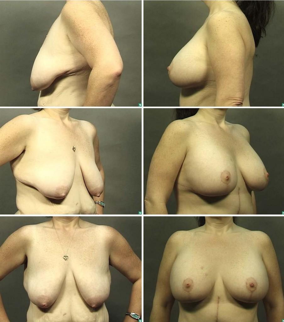 Nintendo reccomend before and after nude weight loss pics