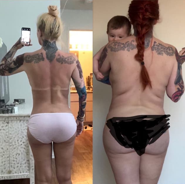 Ember reccomend before and after nude weight loss pics