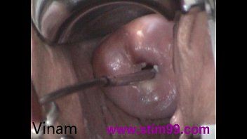 best of Pics with cervix fucking porn