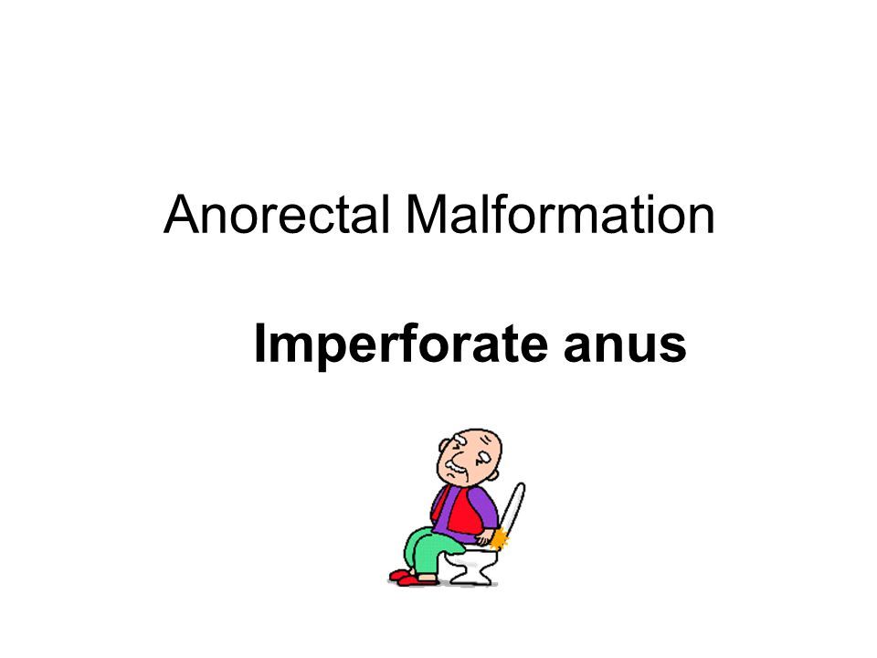 Snappie reccomend Pediatric imperforate anus