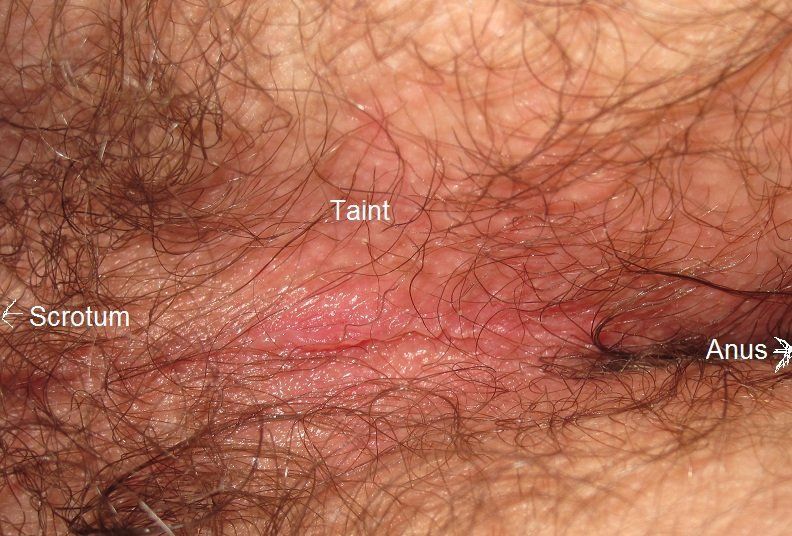 best of Near Painful anus sores