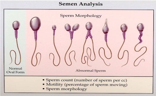 best of Hospital analysis Jupiter sperm