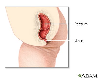 Iron reccomend Pediatric imperforate anus