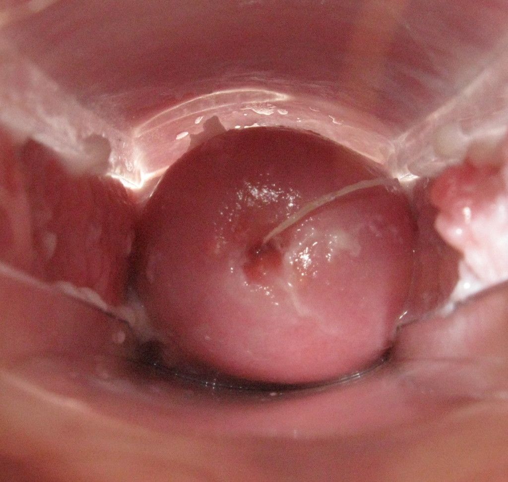 First L. reccomend Sex from inside the vagina